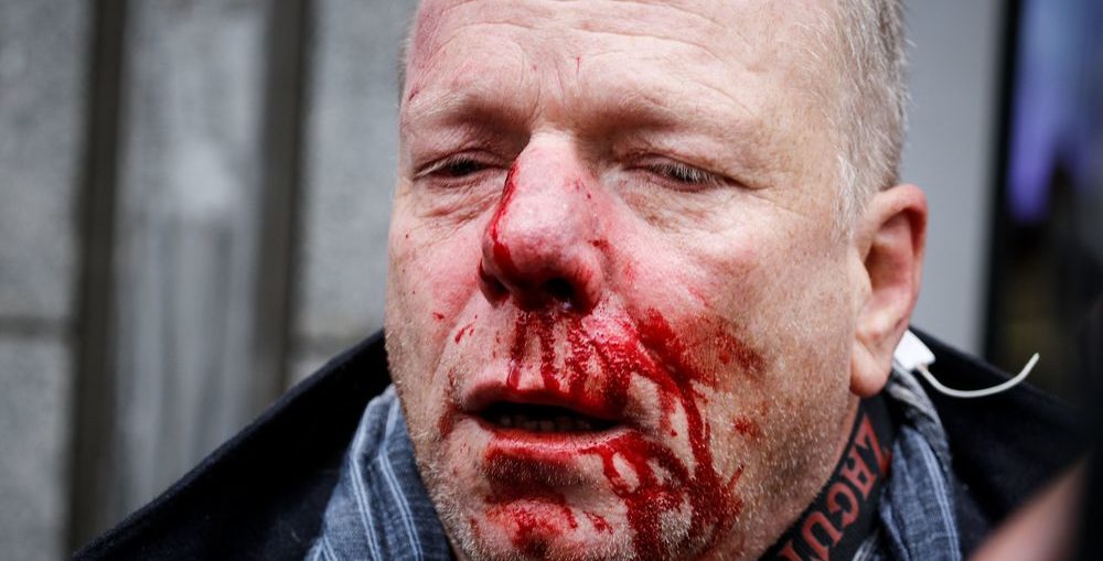 Άγρια επίθεση σε φωτορεπόρτερ της Deutche Welle από ακροδεξιούς στο Σύνταγμα