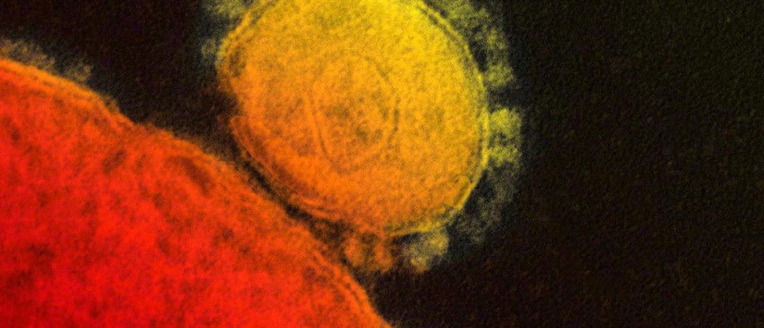 Ρώμη:”Απομονώθηκε” από Ιταλούς γιατρούς ο γενετικός κώδικας του κωρονοϊού- Σημαντική εξέλιξη για την θεραπεία