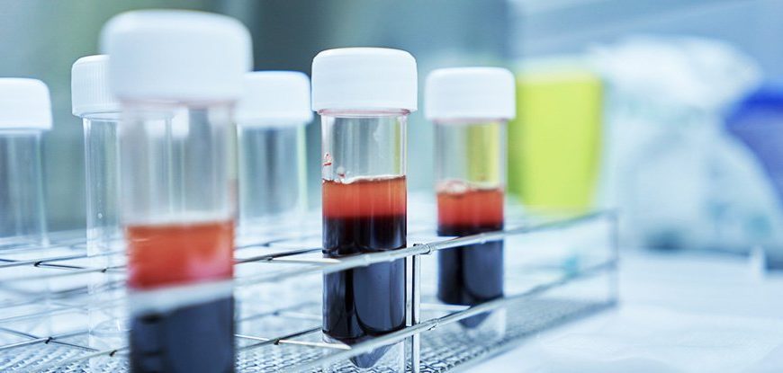 Γερμανική εταιρεία υποστηρίζει πως θα έχει έτοιμο το εμβόλιο μέχρι το φθινόπωρο