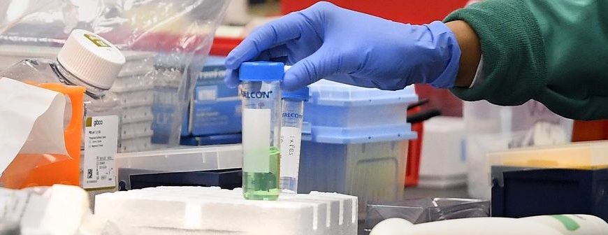 Σύψας: Θα έχουμε χιλιάδες νέα κρούσματα τις επόμενες ημέρες- Φοβόμαστε για το&hellip;