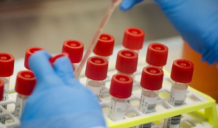 Η μάχη του εμβολίου- Πόσο αισιόδοξοι είναι οι επιστήμονες