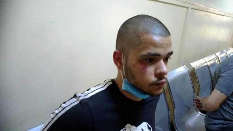 Σημάδια άγριου ξυλοδαρμού φέρει ο 18χρονος διαδηλωτής που συνελήφθη στην πορεία της Πέμπτης