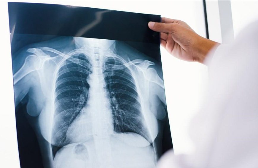 Σαρώνει παγκοσμίως ο καρκίνος στους κάτω των 50