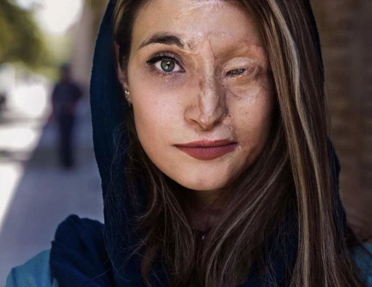 Όταν η τόλμη για πρόοδο και η ομορφιά δεν εκφοβίζονται