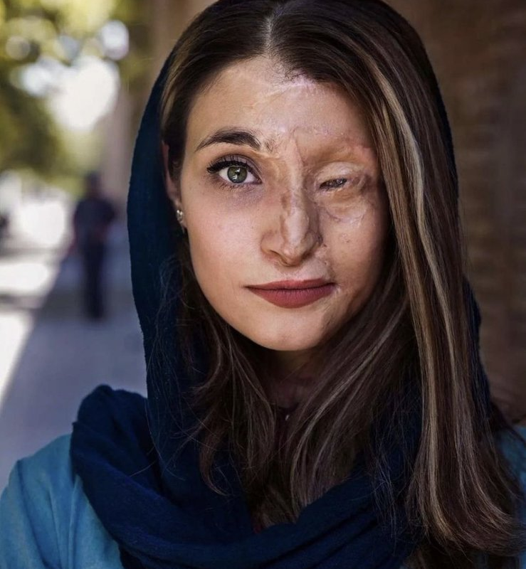 Όταν η τόλμη για πρόοδο και η ομορφιά δεν εκφοβίζονται