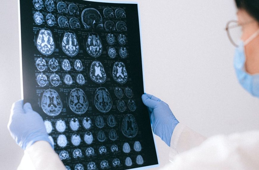 Δημιουργία Εθνικού Δικτύου 17 Μονάδων Εγκεφαλικών