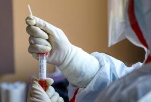 Πέντε χρόνια μετά την εμφάνιση του covid είμαστε προετοιμασμένοι να…