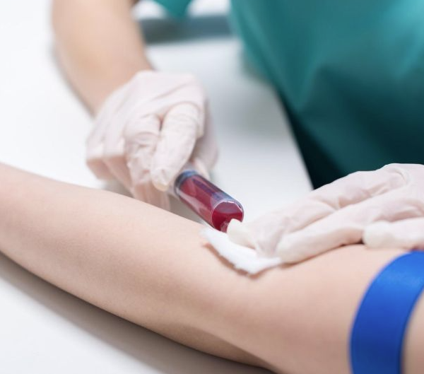 Υποδόρια Ένεση Nivolumab: Μια Επανάσταση στη Θεραπεία του Καρκίνου